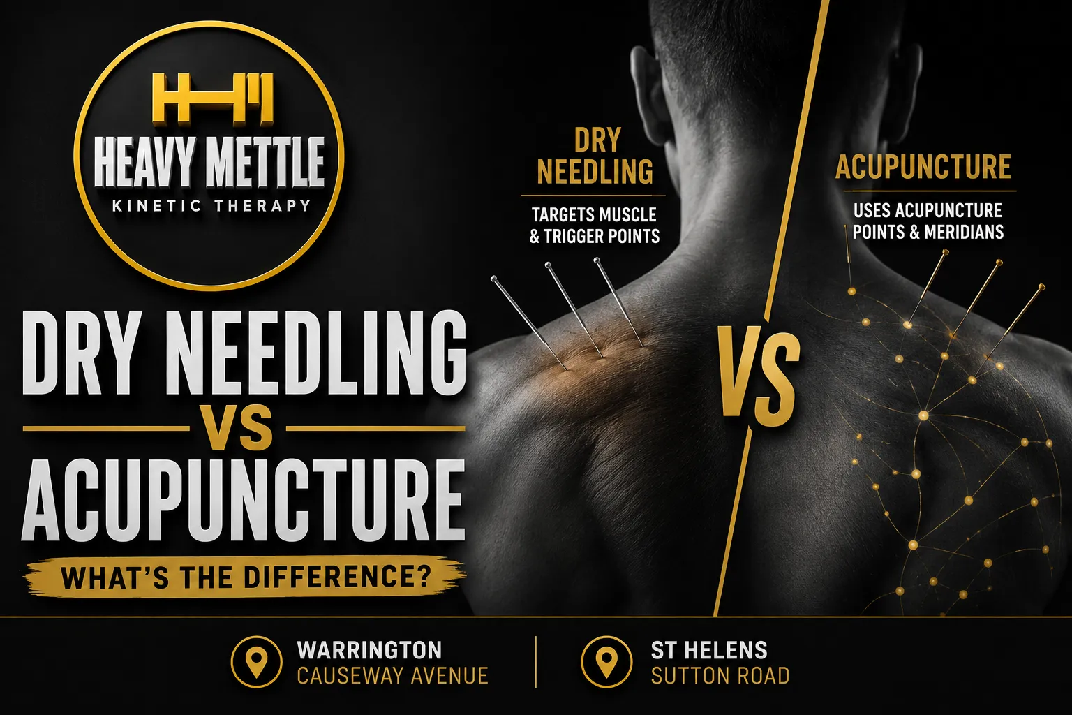 Dry Needling VS Accupiunture: What's The Difference? Warrington & St Helens