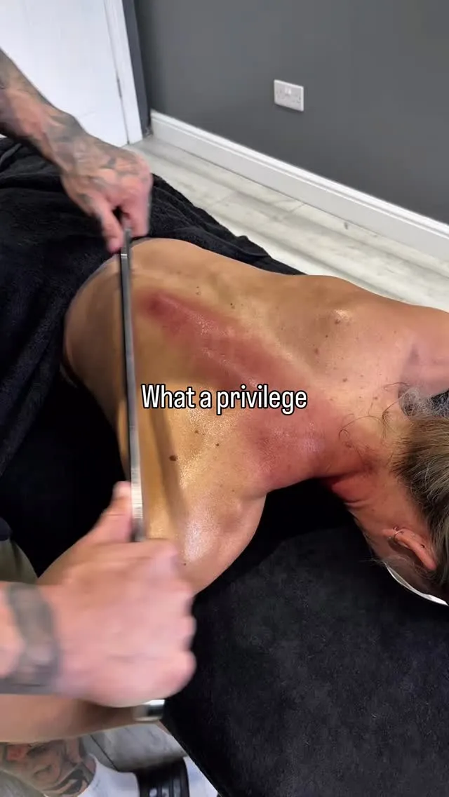 Reel: helping people get out of pain